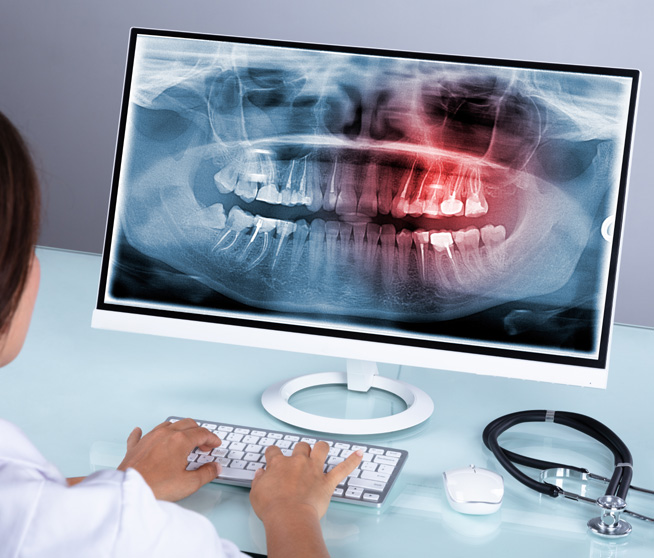 Teeth X-ray